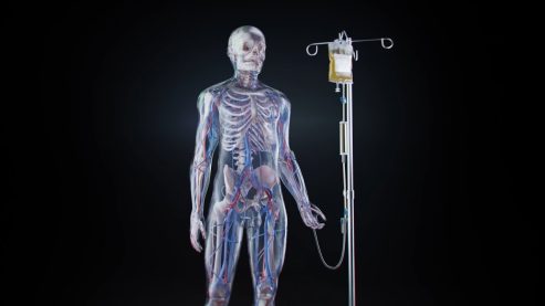 Medical visualization “Cerebrolysin”